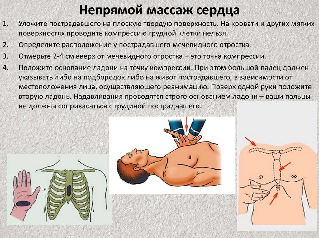 Массаж сердца