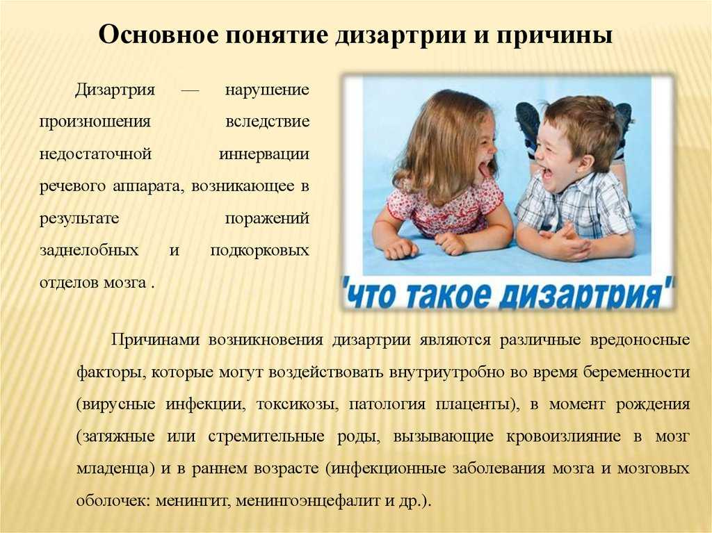 Дизартрия
