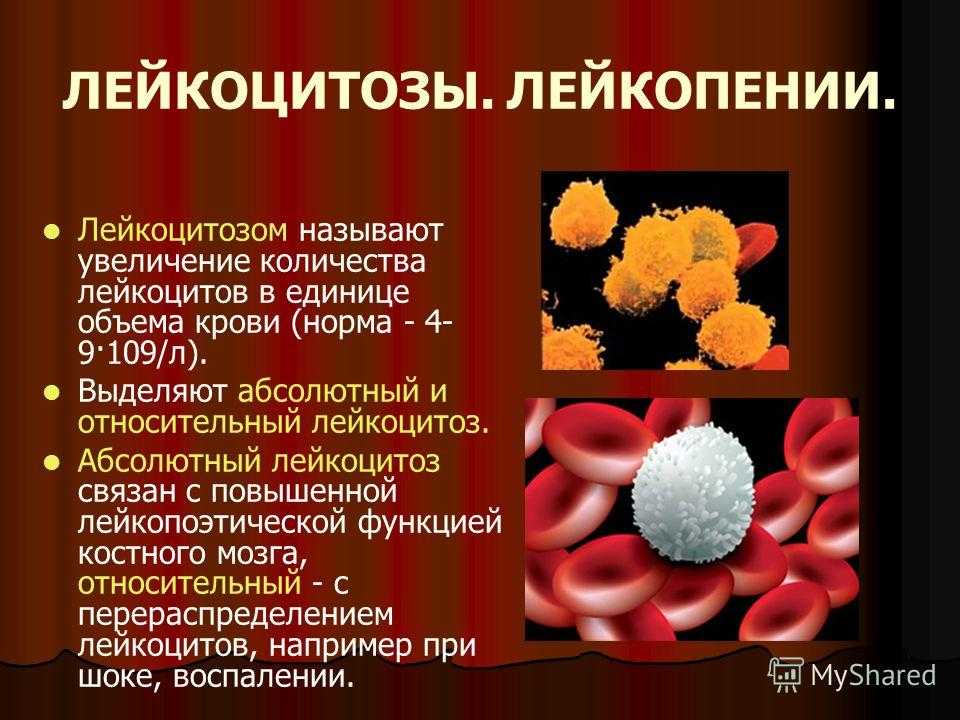 Абсолютный лейкоцитоз. Лейкоцитозы, лейкозы и лейкопении.. Лейкоцитоз и лейкопения. Лейкоциты в крови лейкопения. Уменьшение количества лейкоцитов.