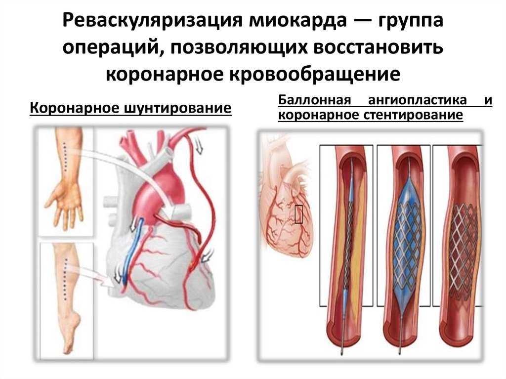 Анатомия плечевой артерии человека – информация: