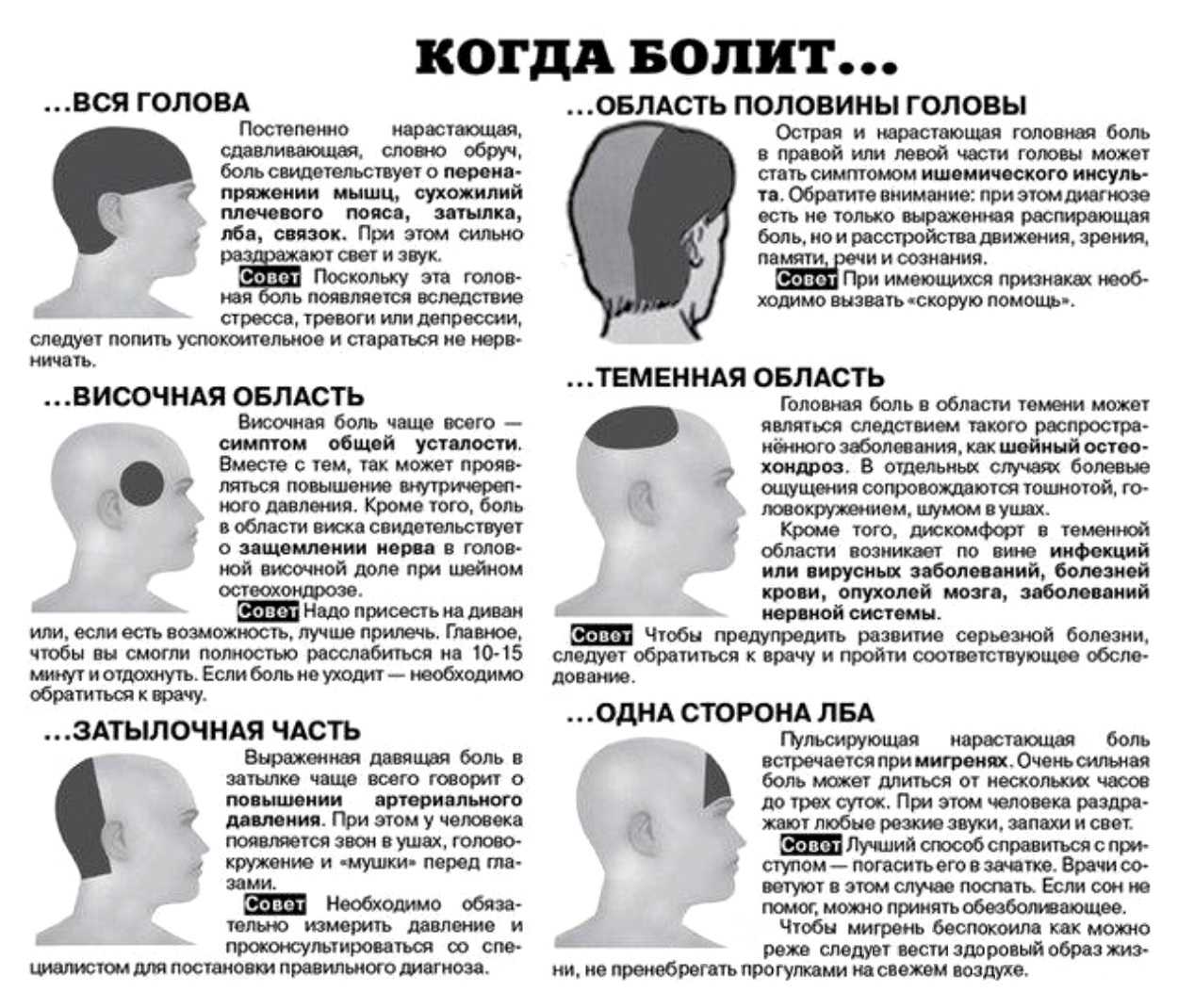 Лечение головных болей