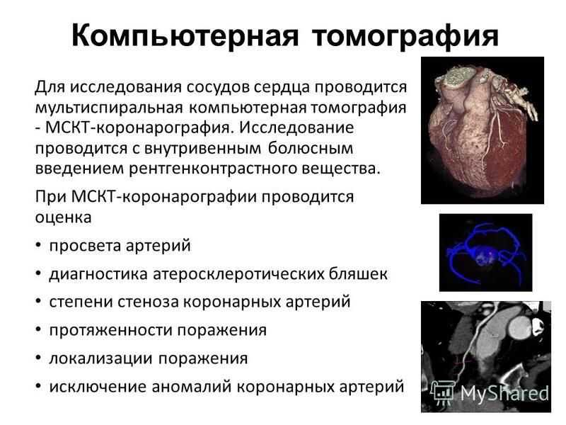 Исследование коронарного кальция. Мультиспиральная кт сердца сосудов сердца. Кт-ангиография коронарных артерий. Кт сердца и коронарных сосудов.