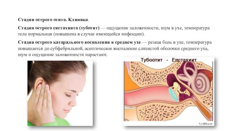 Как избавиться от ощущения воды в ухе?