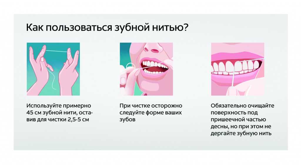 Реабилитация после нитевого лифтинга