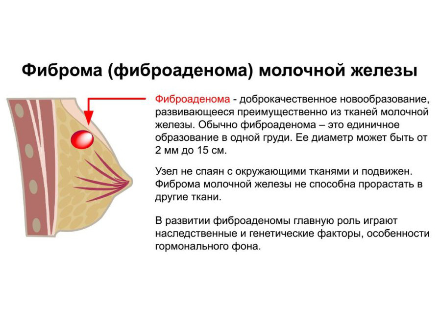 Биопсия при подозрении на колоректальный рак