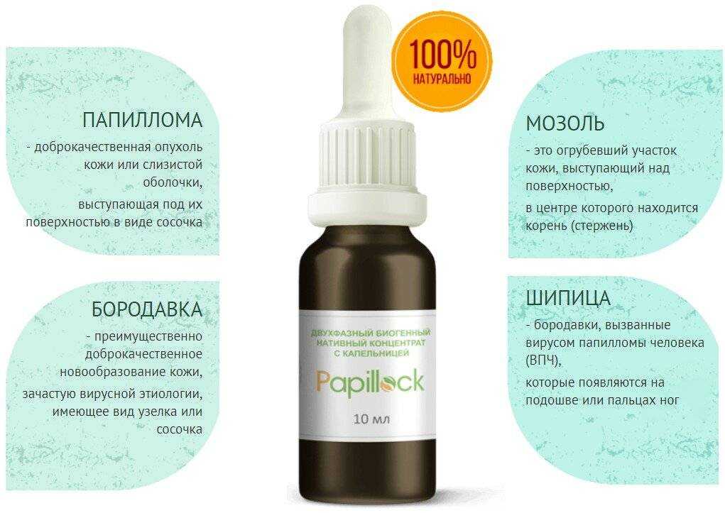 Пяточная шпора