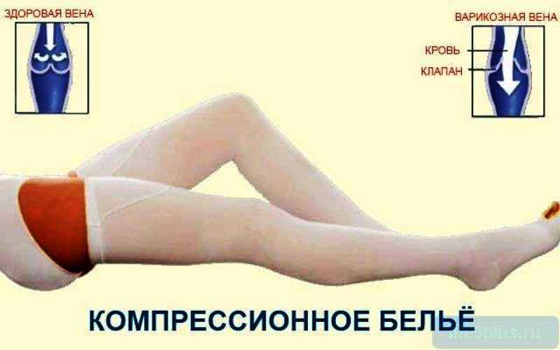 Компрессионные чулки: классификация, показания, как ухаживать | food and health