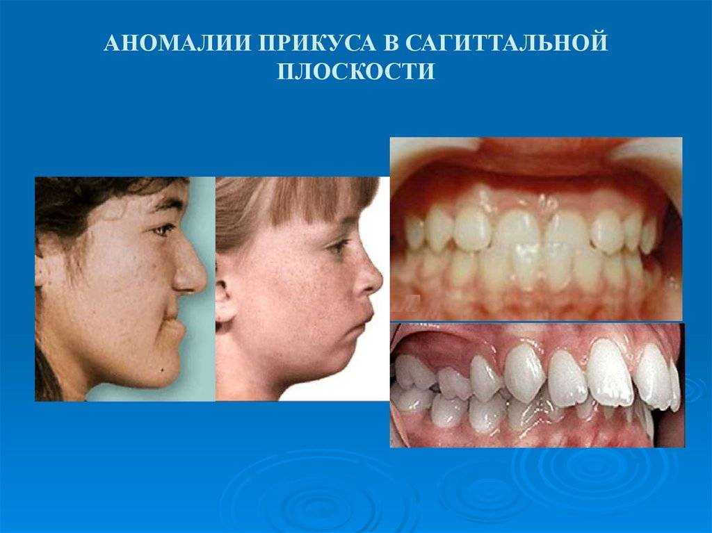 Формируйте прикус с детства