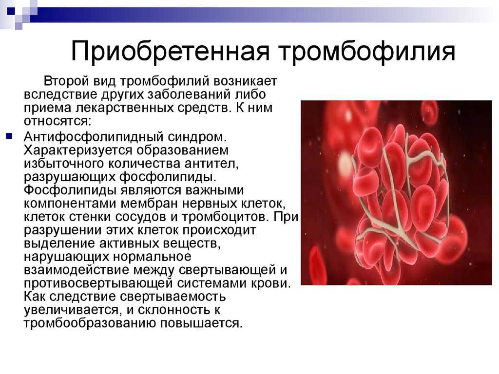 Тромбофилия: генетические тесты на тромбоз