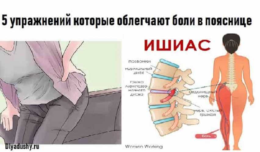 Острая боль в пояснице – международные рекомендации по диагностике и лечению