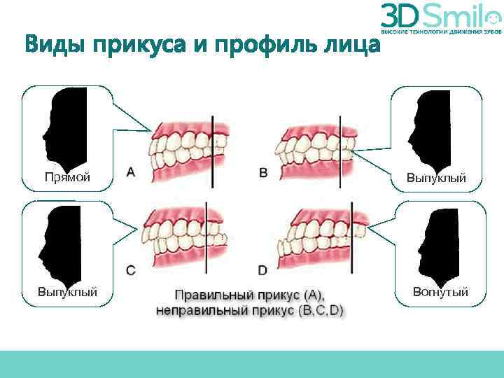 Прикус у ребенка: можно ли предотвратить нарушения? – стоматология президент