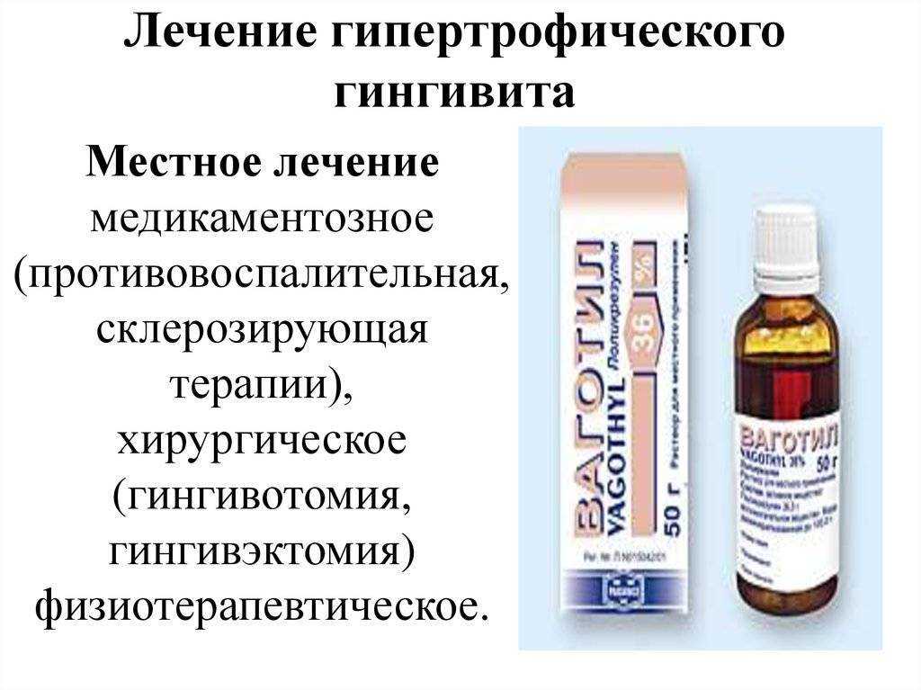 Симптомы и лечение гингивита у взрослых