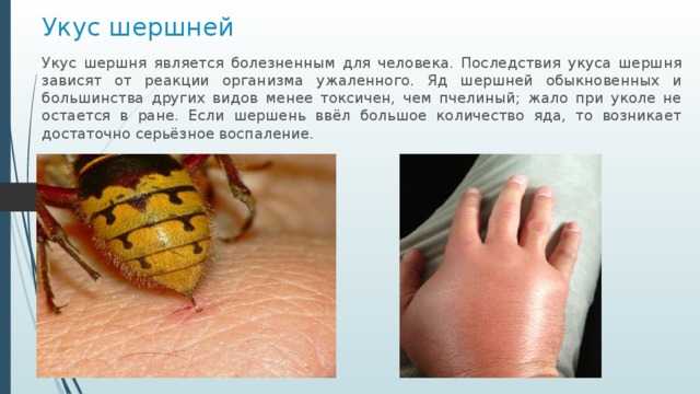 Как лечить укусы ос или шершней: 10 шагов