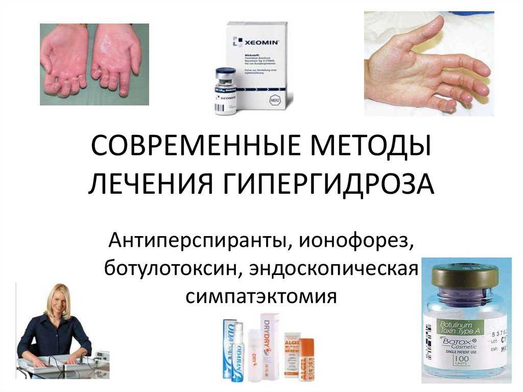 Гипергидроз ладоней — медицинский центр «целитель»