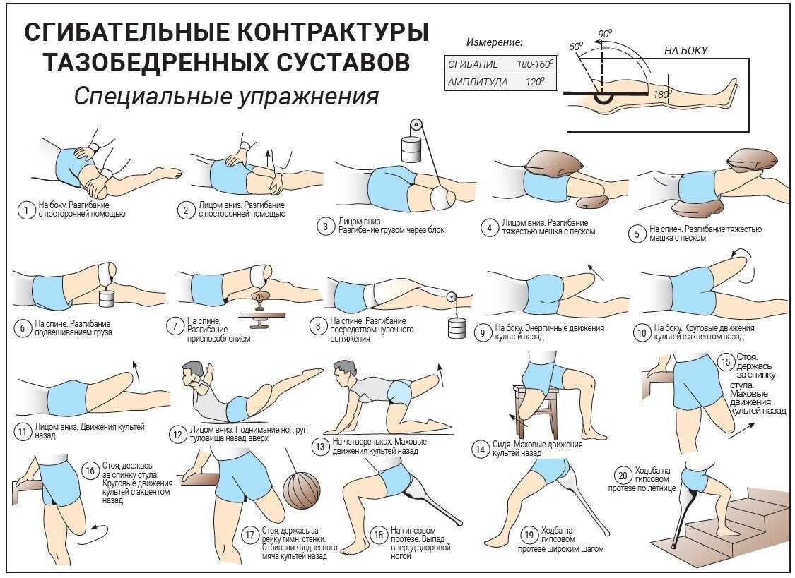 Анкилоз суставов: тазобедренный, коленный, локтевой. что это такое и способы лечения