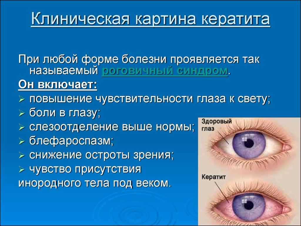 Конъюнктивит у ребенка до года: причины, как и чем лечить, а также способы диагностики
